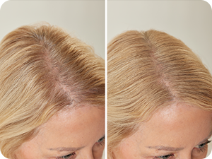 Images de comparaison avant et après montrant les résultats de la coiffure, illustrant les changements de volume et de coiffage des cheveux.