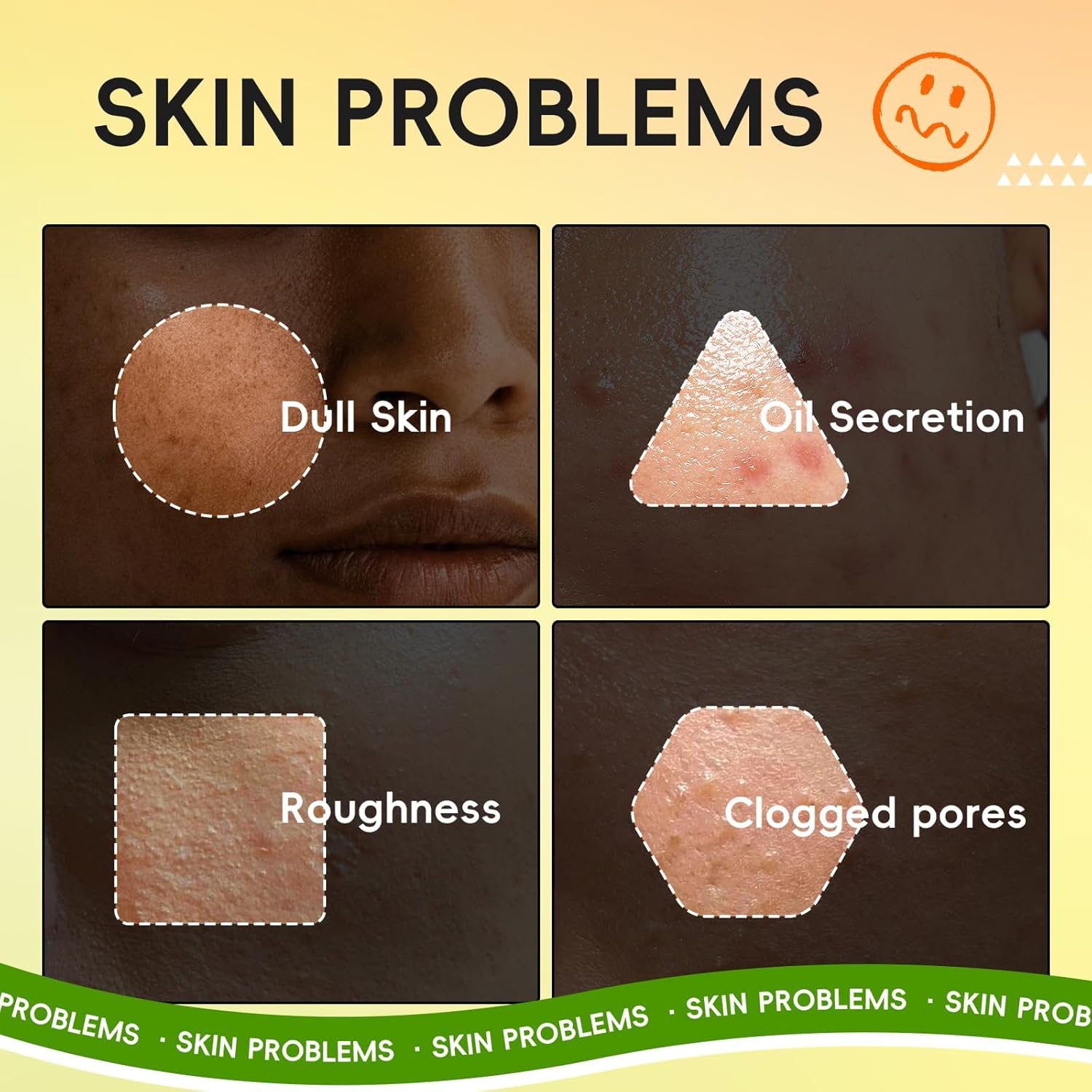 Kit de soins de la peau – 5 pièces – acide salicylique, vitamine C, contrôle de l’huile, anti-acné, éclaircissant